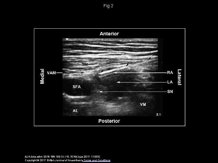 Fig 2 BJA Education 2018 188 -15 DOI: (10. 1016/j. bjae. 2017. 11. 003)
