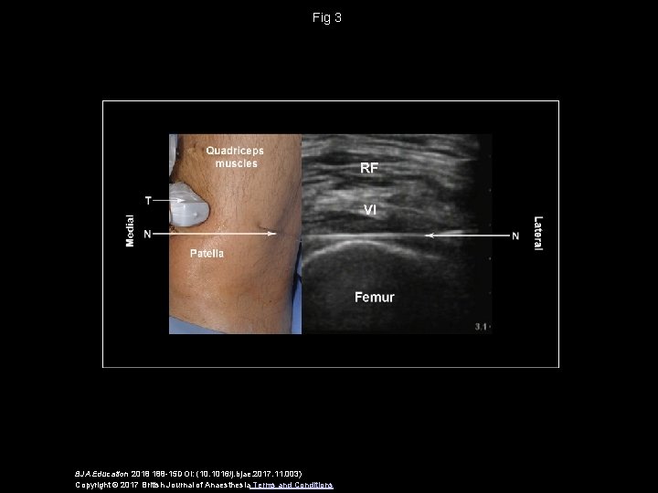 Fig 3 BJA Education 2018 188 -15 DOI: (10. 1016/j. bjae. 2017. 11. 003)