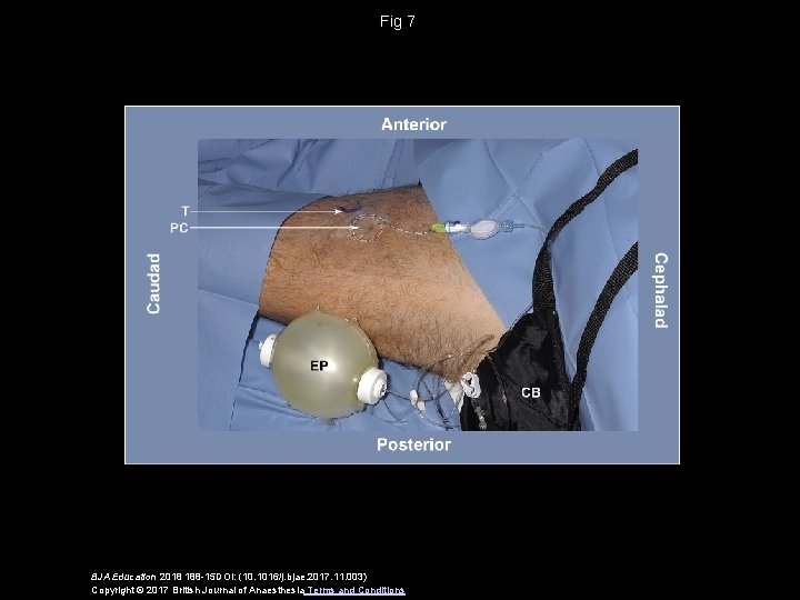 Fig 7 BJA Education 2018 188 -15 DOI: (10. 1016/j. bjae. 2017. 11. 003)