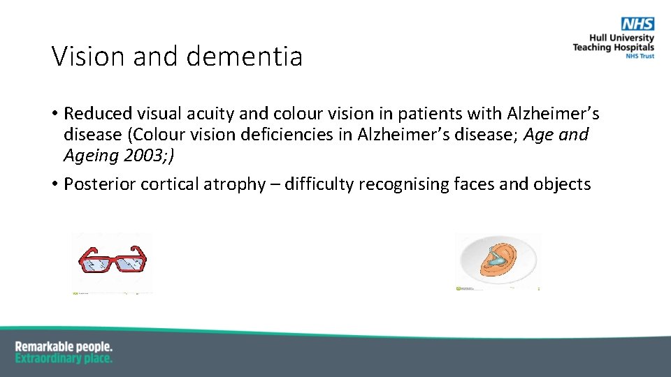 Vision and dementia • Reduced visual acuity and colour vision in patients with Alzheimer’s