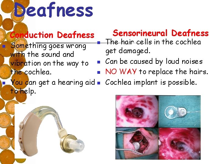 Deafness Sensorineural Deafness Conduction Deafness n n Something goes wrong with the sound and