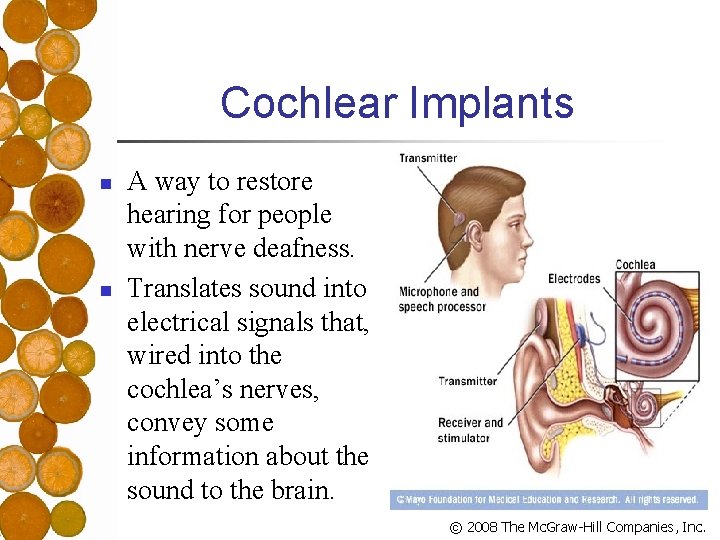 Cochlear Implants n n A way to restore hearing for people with nerve deafness.
