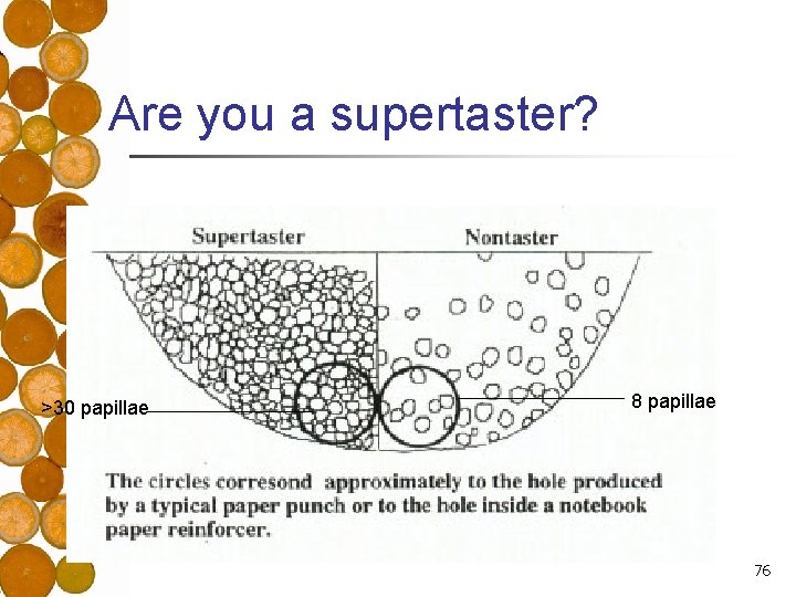Are you a supertaster? >30 papillae 8 papillae 76 