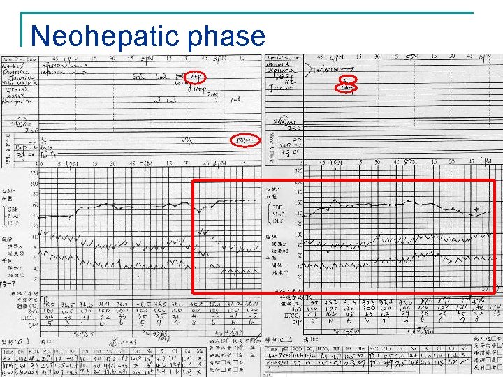 Neohepatic phase 