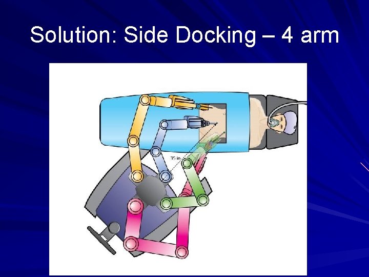 Solution: Side Docking – 4 arm 