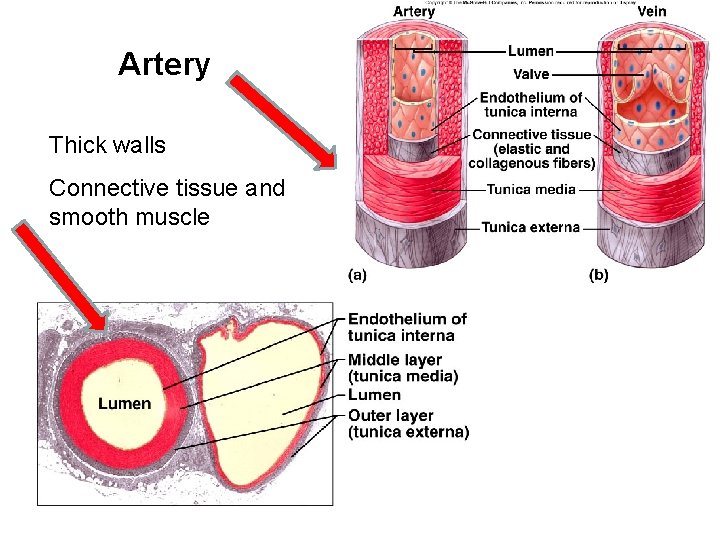 Artery Thick walls Connective tissue and smooth muscle 