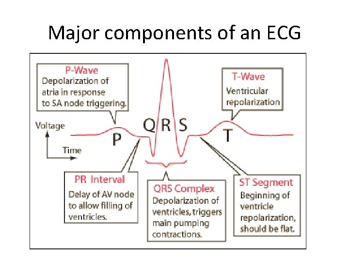 Major components of an ECG 