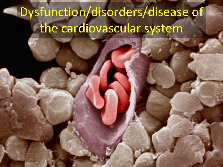 Dysfunction/disorders/disease of the cardiovascular system 