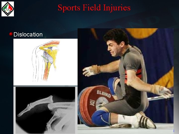 Sports Field Injuries Dislocation Dr. taghavi 