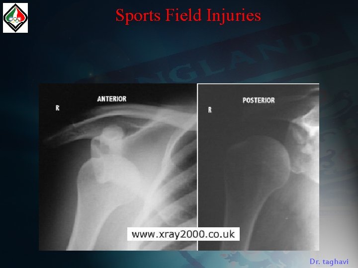 Sports Field Injuries Dr. taghavi 