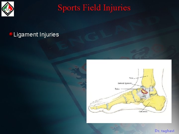 Sports Field Injuries Ligament Injuries Dr. taghavi 