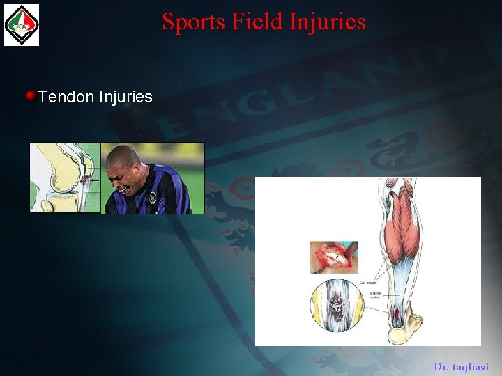 Sports Field Injuries Tendon Injuries Dr. taghavi 