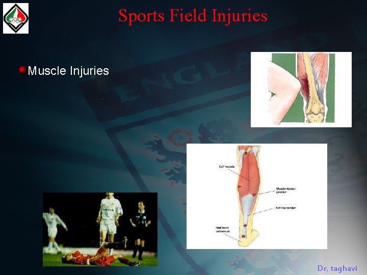 Sports Field Injuries Muscle Injuries Dr. taghavi 
