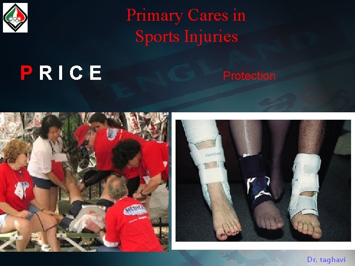 Primary Cares in Sports Injuries PRICE Protection Dr. taghavi 