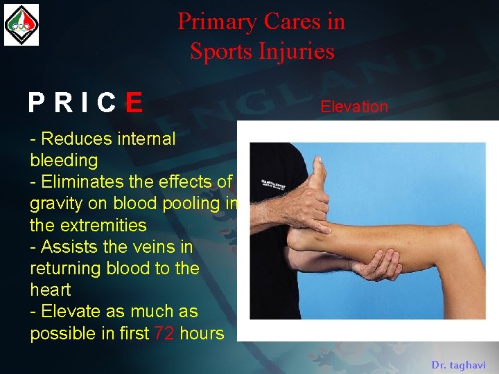 Primary Cares in Sports Injuries PRICE Elevation - Reduces internal bleeding - Eliminates the