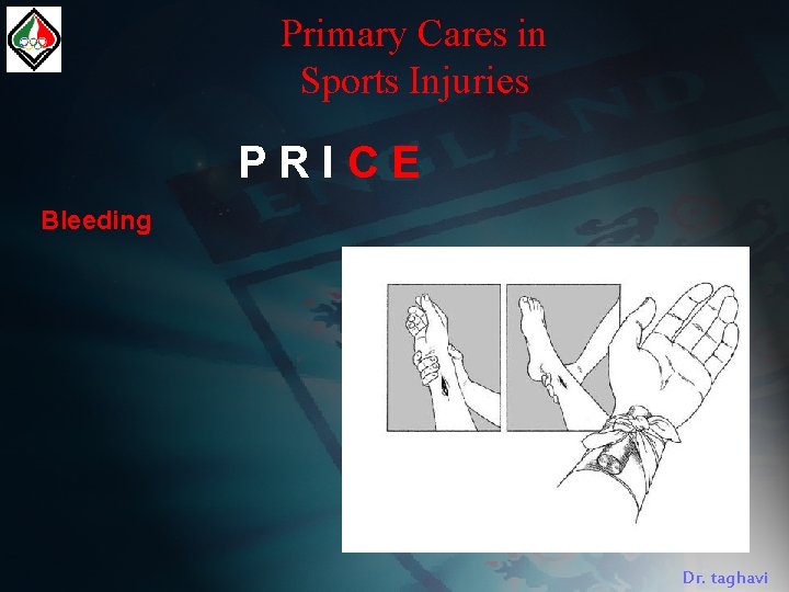 Primary Cares in Sports Injuries PRICE Bleeding Dr. taghavi 