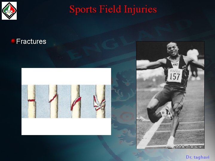 Sports Field Injuries Fractures Dr. taghavi 