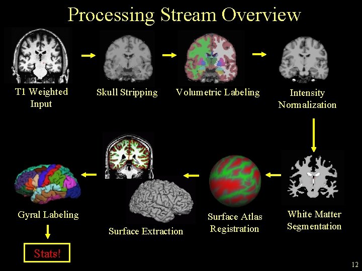 Processing Stream Overview T 1 Weighted Input Skull Stripping Volumetric Labeling Gyral Labeling Surface