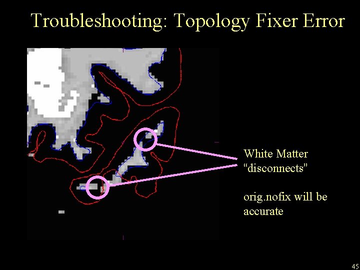 Troubleshooting: Topology Fixer Error White Matter “disconnects” orig. nofix will be accurate 45 