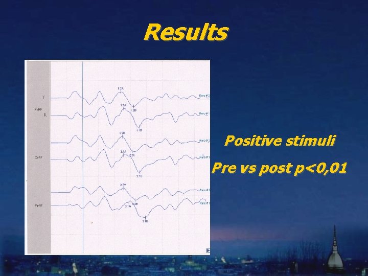 Results Positive stimuli Pre vs post p<0, 01 