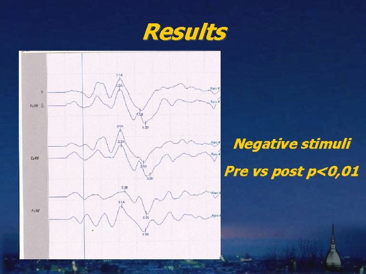 Results Negative stimuli Pre vs post p<0, 01 