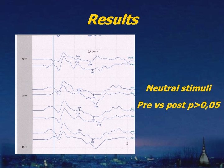 Results Neutral stimuli Pre vs post p>0, 05 