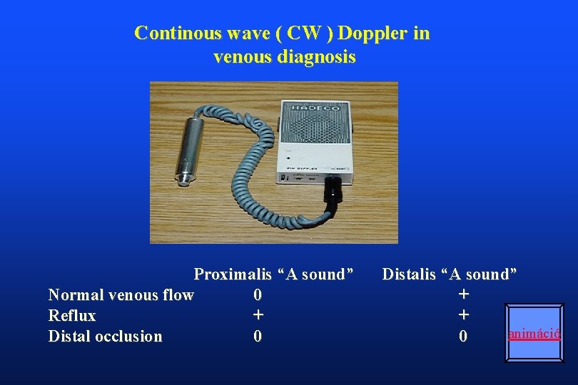 Continous wave ( CW ) Doppler in venous diagnosis Proximalis “A sound” Normal venous