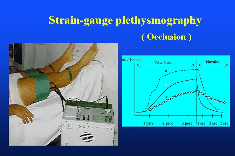 Strain-gauge plethysmography ( Occlusion ) 