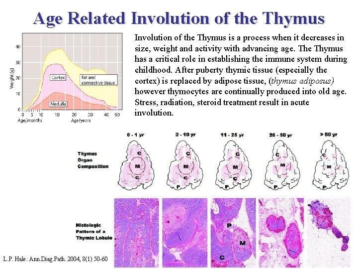 Age Related Involution of the Thymus is a process when it decreases in size,