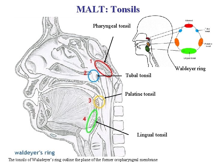 MALT: Tonsils Pharyngeal tonsil Waldeyer ring Tubal tonsil Palatine tonsil Lingual tonsil The tonsils