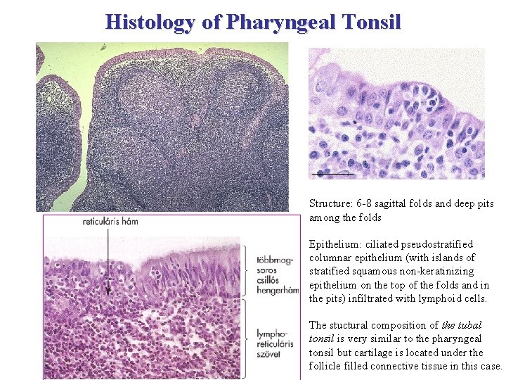 Histology of Pharyngeal Tonsil Structure: 6 -8 sagittal folds and deep pits among the