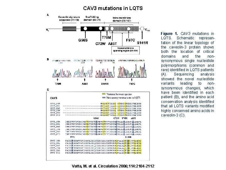 CAV 3 mutations in LQTS Figure 1. CAV 3 mutations in LQTS. Schematic representation