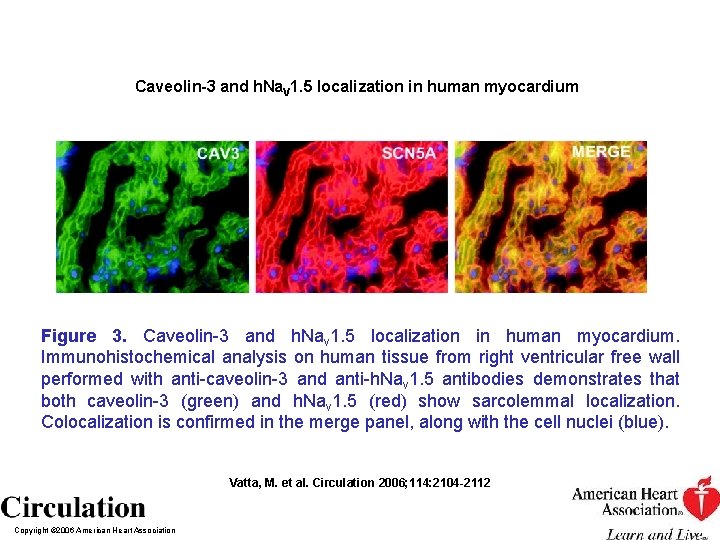 Caveolin-3 and h. Na. V 1. 5 localization in human myocardium Figure 3. Caveolin-3