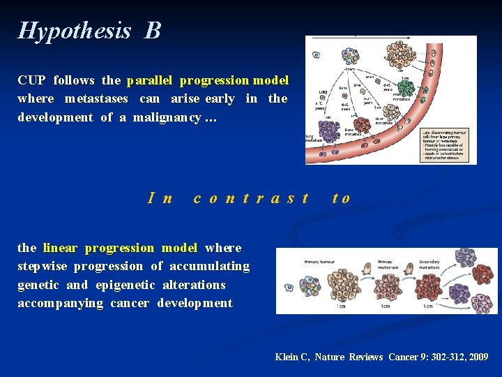 Hypothesis B CUP follows the parallel progression model where metastases can arise early in