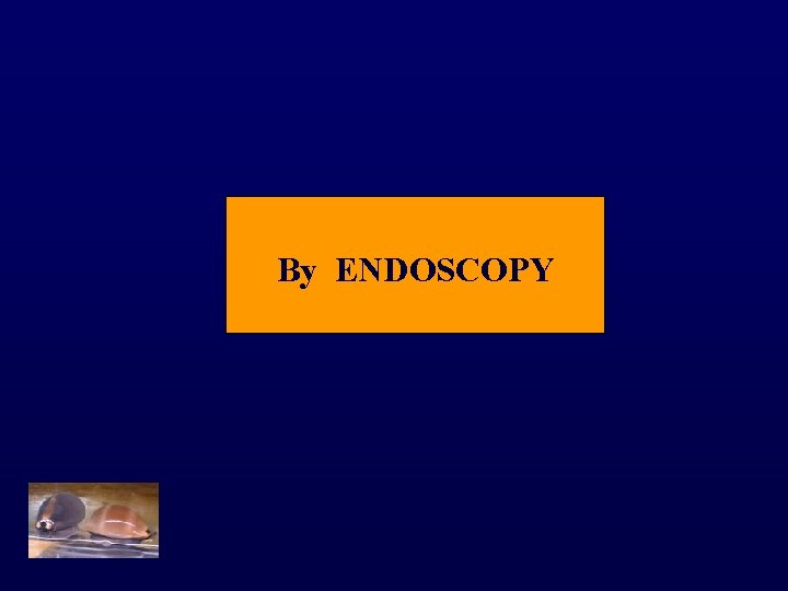 By ENDOSCOPY 