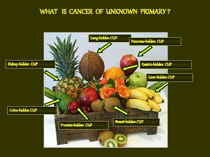 WHAT IS CANCER OF UNKNOWN PRIMARY ? Lung-hidden CUP Kidney-hidden CUP Pancreas-hidden CUP Gastric-hidden