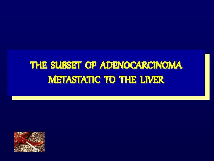 THE SUBSET OF ADENOCARCINOMA METASTATIC TO THE LIVER 