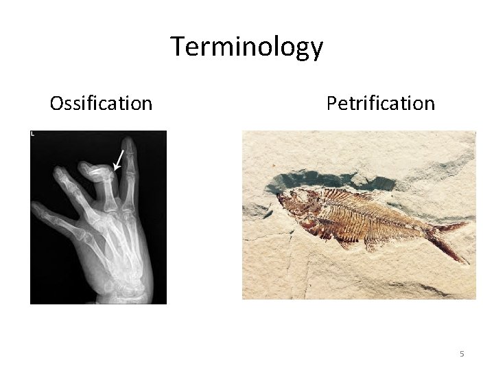 Terminology Ossification Petrification 5 