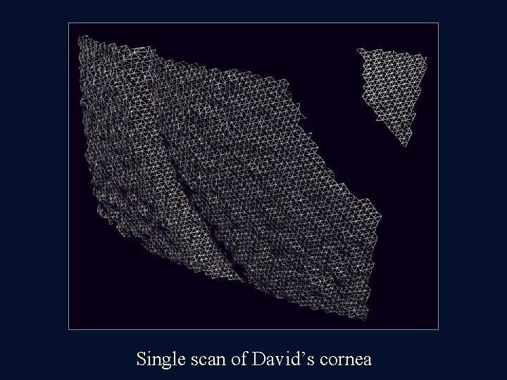 Single scan of David’s cornea Single scan of David’s cornea