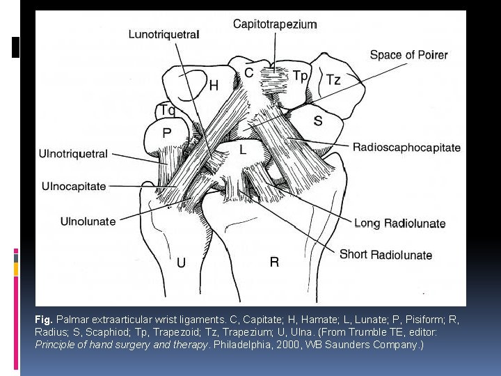 Fig. Palmar extraarticular wrist ligaments. C, Capitate; H, Hamate; L, Lunate; P, Pisiform; R,