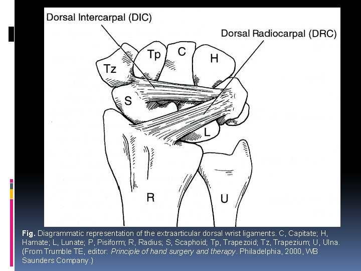 Fig. Diagrammatic representation of the extraarticular dorsal wrist ligaments. C, Capitate; H, Hamate; L,