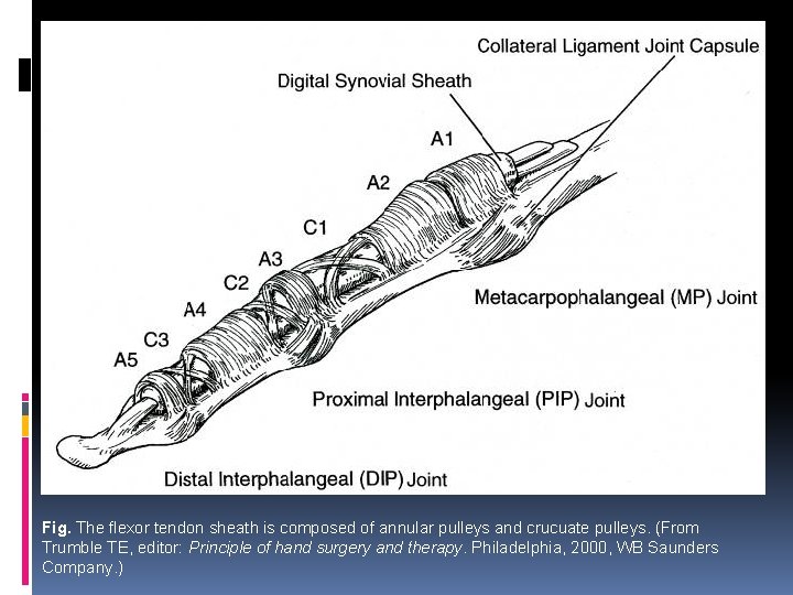Fig. The flexor tendon sheath is composed of annular pulleys and crucuate pulleys. (From
