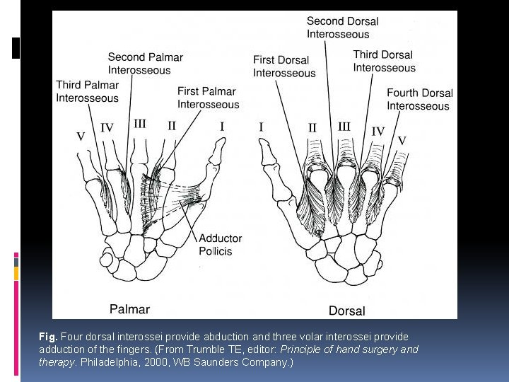 Fig. Four dorsal interossei provide abduction and three volar interossei provide adduction of the