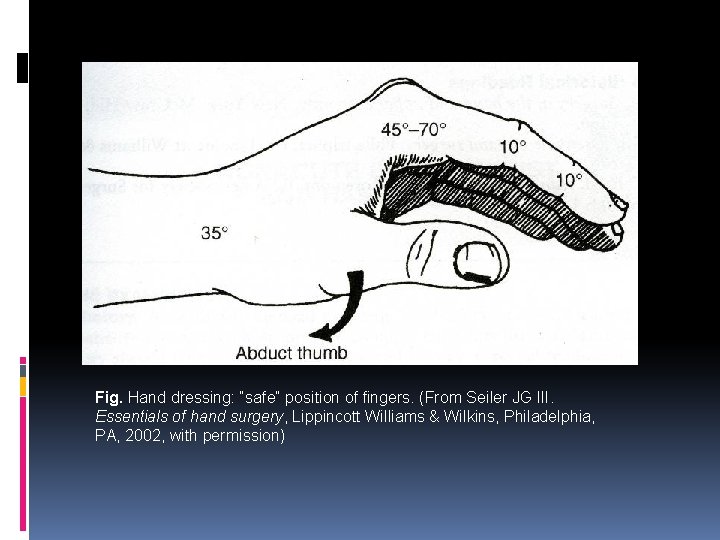 Fig. Hand dressing: “safe” position of fingers. (From Seiler JG III. Essentials of hand