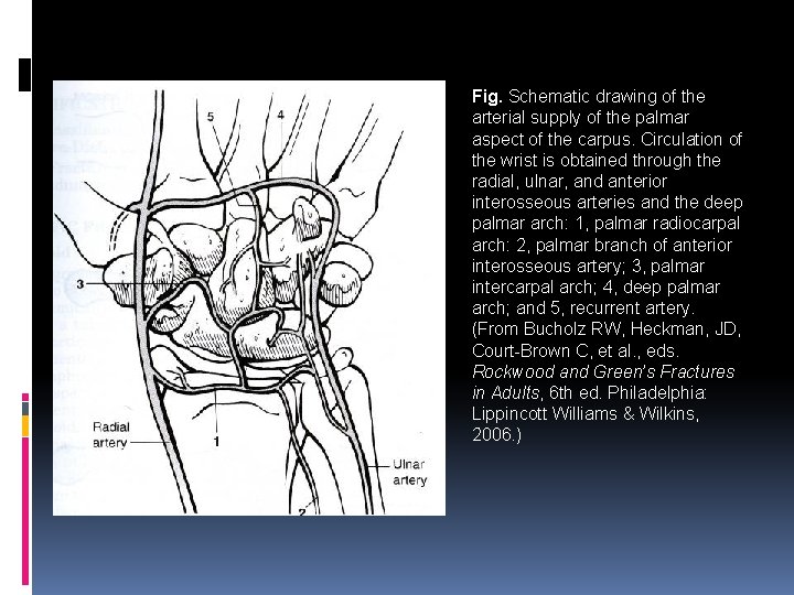 Fig. Schematic drawing of the arterial supply of the palmar aspect of the carpus.