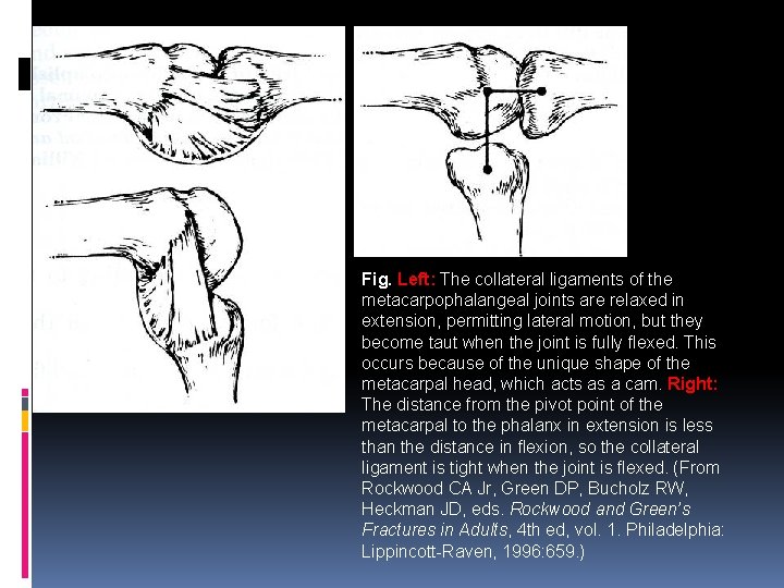 Fig. Left: The collateral ligaments of the metacarpophalangeal joints are relaxed in extension, permitting