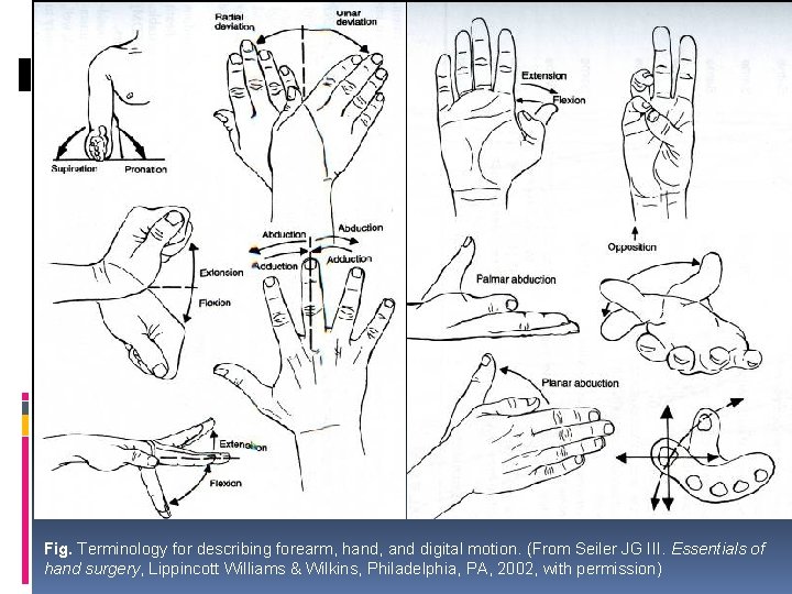 Fig. Terminology for describing forearm, hand, and digital motion. (From Seiler JG III. Essentials