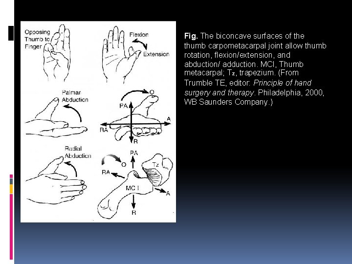 Fig. The biconcave surfaces of the thumb carpometacarpal joint allow thumb rotation, flexion/extension, and