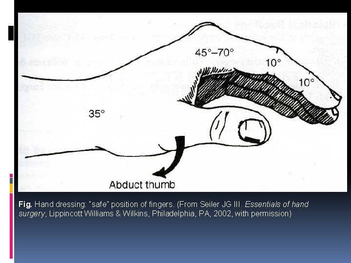 Fig. Hand dressing: “safe” position of fingers. (From Seiler JG III. Essentials of hand