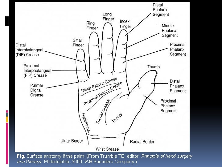 Fig. Surface anatomy if the palm. (From Trumble TE, editor: Principle of hand surgery